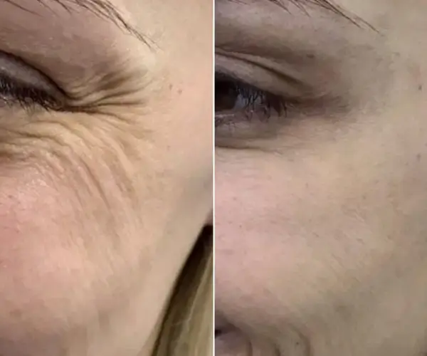 antes-x-depois-20